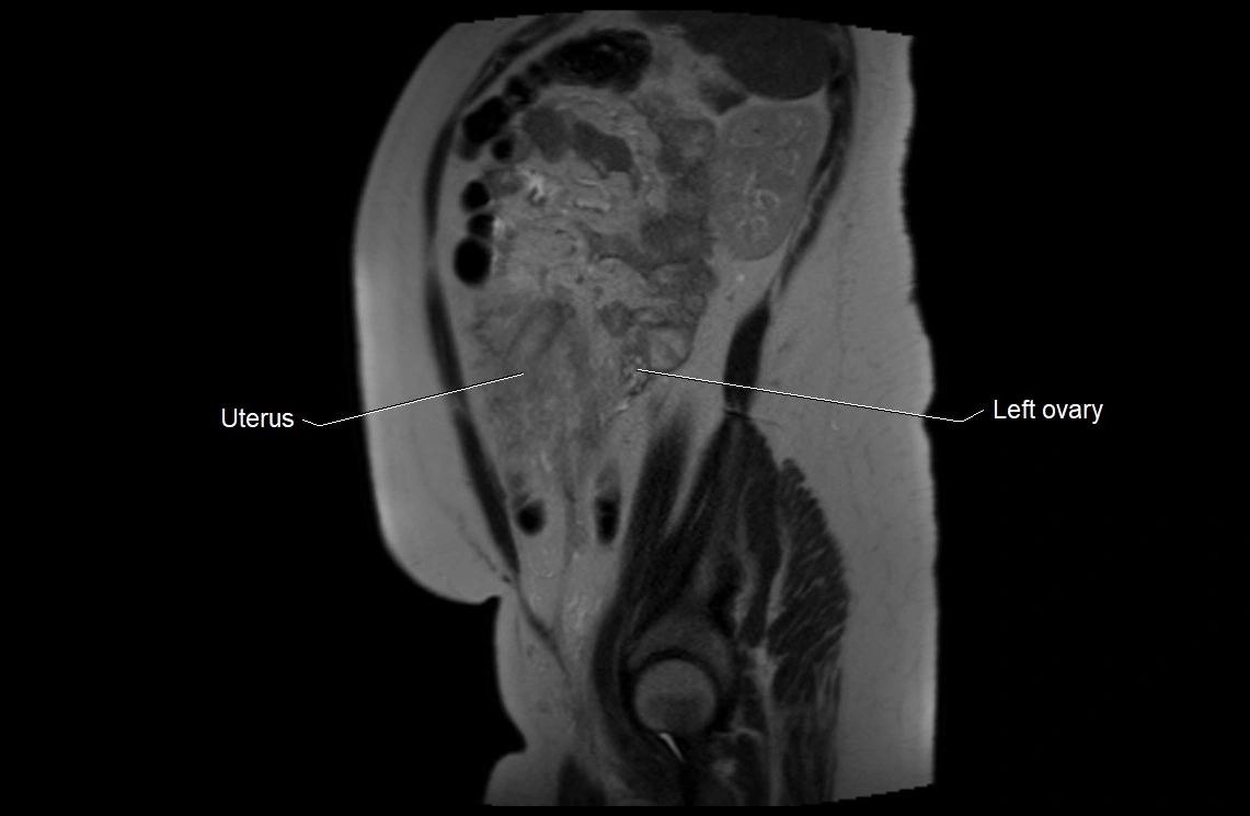 MRI fetal anatomy sagittal image 29.webp
